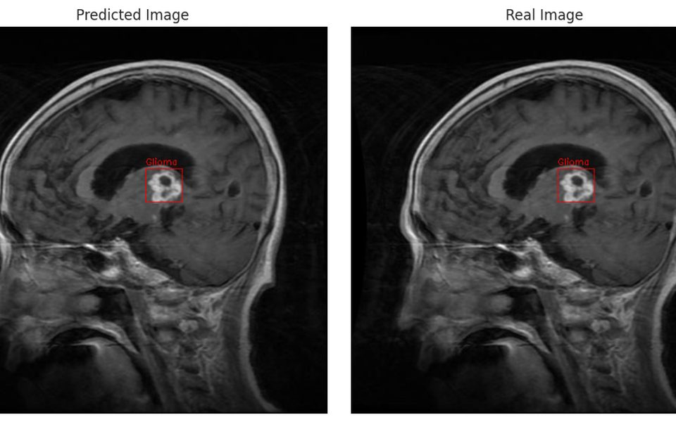 Brain Tumor Detection screenshot